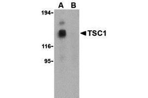 Western Blotting (WB) image for anti-Tuberous Sclerosis 1 (TSC1) (Middle Region) antibody (ABIN1031146) (TSC1 anticorps  (Middle Region))