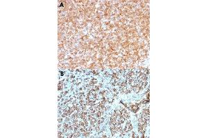 Immunohistochemical staining (Formalin-fixed paraffin-embedded sections) of human tonsil with HLA-DP/HLA-DQ/HLA-DR monoclonal antibody, clone CR3/43 . (HLA-DPB1 anticorps)
