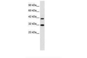 Image no. 1 for anti-D4, Zinc and Double PHD Fingers Family 1 (DPF1) (AA 229-278) antibody (ABIN6735926) (DPF1 anticorps  (AA 229-278))