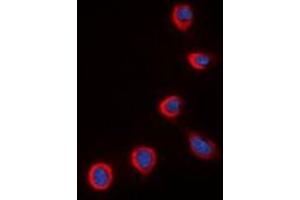 Immunofluorescent analysis of COX4-2 staining in K562 cells. (COX4I2 anticorps)