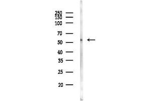 anti-Protein Phosphatase 2, Regulatory Subunit B', beta (PPP2R5B) antibody