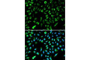Immunofluorescence analysis of A549 cells using NME1 antibody. (NME1 anticorps  (C-Term))