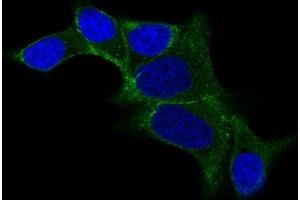 IF staining of LNCap cells using AF488 labeled ODC1 Monoclonal Antibody (ODC1/487) (Green). (ODC1 anticorps)