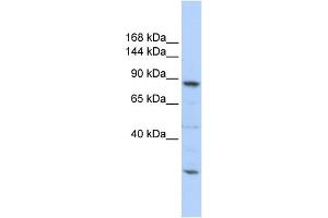 WB Suggested Anti-CDC5L Antibody Titration:  0. (CDC5L anticorps  (Middle Region))