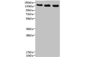 Western blot All lanes: ANKS1B antibody at 5.