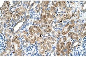 Human kidney (VMA21 anticorps  (N-Term))