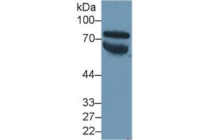 Detection of VTN in Human Serum using Polyclonal Antibody to Vitronectin (VTN) (Vitronectin anticorps  (AA 19-468))