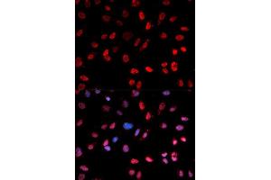 Immunofluorescence analysis of MCF7 cell using Phospho-ATF2-T53 antibody.