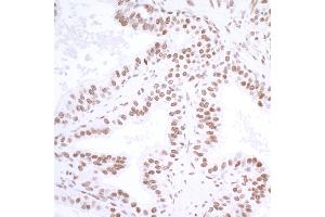 Immunohistochemistry (IHC) image for anti-Ubiquitin Specific Peptidase 7 (Herpes Virus-Associated) (USP7) (AA 1-50) antibody (ABIN7453991) (Recombinant USP7 anticorps  (AA 1-50))