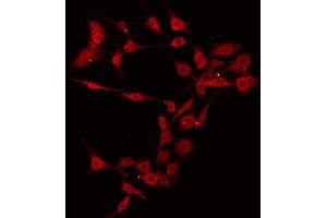 ABIN6266499 staining 293 by IF/ICC. (BAK1 anticorps  (N-Term))