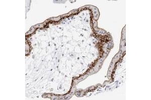Immunohistochemical staining of human placenta with SLC19A1 polyclonal antibody  shows strong membranous positivity in trophoblastic cells at 1:200-1:500 dilution.