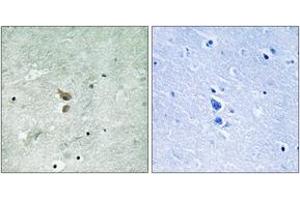 Immunohistochemistry analysis of paraffin-embedded human brain, using RIPK2 (Phospho-Ser176) Antibody.