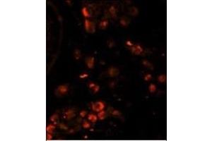 Immunofluorescence analysis of LIN28A Monoclonal Antibody with paraffin-embedded human testis tissue.