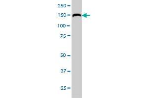 RAPGEF6 monoclonal antibody (M01), clone 2C5 Western Blot analysis of RAPGEF6 expression in Hela S3 NE .