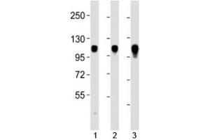 Western blot testing of Integrin alpha 7 antibody at 1:2000 dilution.