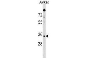 SNAPC2 Antibody (C-term) western blot analysis in Jurkat cell line lysates (35µg/lane). (SNAPC2 anticorps  (C-Term))