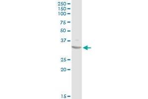 SDHB MaxPab rabbit polyclonal antibody.