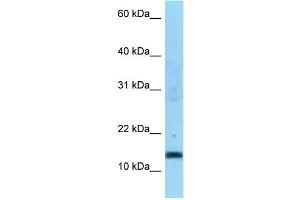 WB Suggested Anti-SDHC Antibody Titration: 1. (SDHC anticorps  (Middle Region))