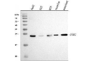 Western blot analysis of SOD2 using anti-SOD2 antibody (ABIN7602799).