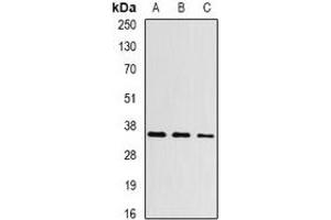 Western blot analysis of Aspartoacylase expression in Hela (A), mouse kidney (B), rat kidney (C) whole cell lysates. (ASPA anticorps)