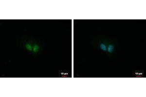 ICC/IF Image IP3KC antibody [N3C2], Internal detects IP3KC protein at nucleus by immunofluorescent analysis. (ITPKC anticorps)