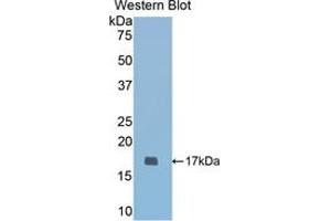Western blot analysis of the recombinant protein. (COMP anticorps  (AA 317-455))