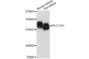 Western blot analysis of extracts of various cell lines, using SLC12A1 antibody. (SLC12A1 anticorps  (AA 50-150))