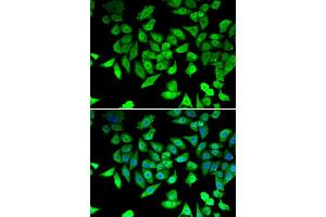 Immunofluorescence analysis of U20S cell using CCAR2 antibody. (CCAR2 anticorps)