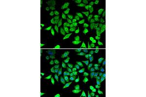 Immunofluorescence analysis of U20S cell using CCAR2 antibody.
