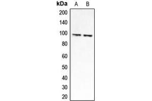 Western blot analysis of CLCN6 expression in HEK293A (A), Jurkat (B) whole cell lysates. (CLCN6 anticorps  (Center))