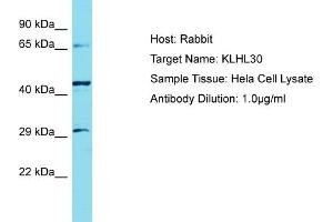 Host: Rabbit Target Name: KLHL30 Sample Tissue: Human Hela Whole Cell Antibody Dilution: 1ug/ml (KLHL30 anticorps  (C-Term))