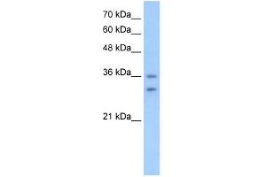 OR6C70 antibody used at 2. (OR6C70 anticorps  (C-Term))