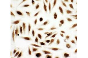 ICC testing of NME2 antibody and HeLa cells