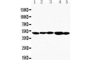 Anti-TIM 1 antibody, Western blotting Lane 1: SMMC Cell Lysate Lane 2: HELA Cell Lysate Lane 3: PANC Cell Lysate Lane 4: MM231 Cell Lysate Lane 5: MM453 Cell Lysate (HAVCR1 anticorps  (C-Term))