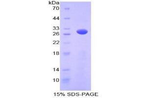 SDS-PAGE analysis of Mouse PRKAg2 Protein. (PRKAG2 Protéine)
