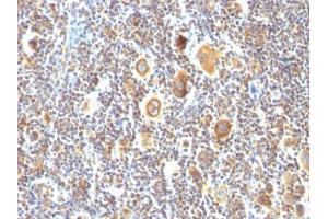 Image no. 2 for anti-B-Cell CLL/lymphoma 6 (BCL6) antibody (ABIN6175703) (BCL6 anticorps)