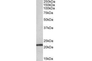 Western Blotting (WB) image for anti-Transmembrane Protein 205 (TMEM205) (Internal Region) antibody (ABIN2464767) (TMEM205 anticorps  (Internal Region))