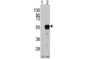Image no. 2 for anti-Aldehyde Dehydrogenase 2 Family (Mitochondrial) (ALDH2) (AA 325-355) antibody (ABIN356918) (ALDH2 anticorps  (AA 325-355))