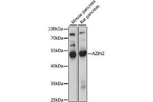 Western blot analysis of extracts of various cell lines, using  antibody (ABIN7265663) at 1000 dilution. (ADC anticorps  (AA 1-360))