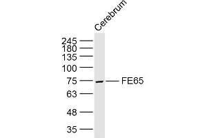 Lane 1: Rat cerebrum lysates probed with FE65 Polyclonal Antibody, Unconjugated (bs-0110R) at 1:300 overnight at 4˚C. (FE65 anticorps  (AA 201-300))
