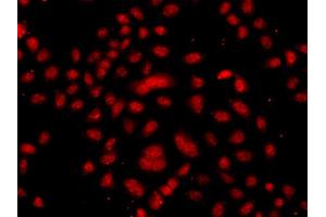 Immunofluorescence analysis of A549 cells using FBXW11 antibody (ABIN5975739). (FBXW11 anticorps)