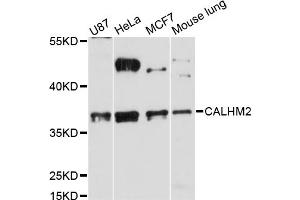 anti-Calcium Homeostasis Modulator 2 (CALHM2) antibody