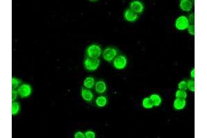 Image no. 2 for anti-Checkpoint Kinase 2 (CHEK2) antibody (ABIN1497496)