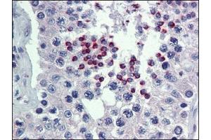 Human Testis: Formalin-Fixed, Paraffin-Embedded (FFPE)