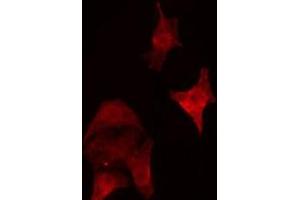 anti-Septin 5 (SEPT5) (Internal Region) antibody