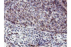 Image no. 2 for anti-Golgi Membrane Protein 1 (GOLM1) antibody (ABIN1498491)