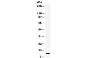Western blot testing of human placenta lysate with DBI antibody at 0. (Diazepam Binding Inhibitor anticorps  (AA 2-187))