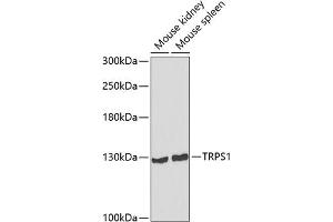 Western blot analysis of extracts of various cell lines, using TRPS1 antibody (ABIN6132997, ABIN6149594, ABIN6149595 and ABIN6223684) at 1:1000 dilution. (TRPS1 anticorps  (AA 20-260))