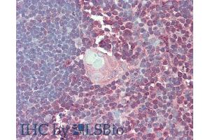 Detection of IFNg in Human Thymus Tissue using Polyclonal Antibody to Interferon Gamma (IFNg)