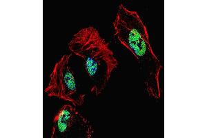 Fluorescent confocal image of Hela cell stained with RARB Antibody (Center) (ABIN1537931 and ABIN2849656). (Retinoic Acid Receptor beta anticorps  (AA 168-195))